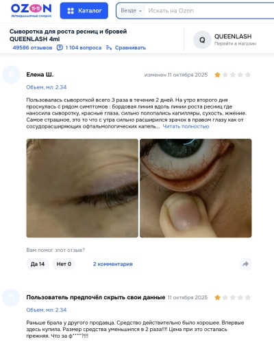 Queenlash отзывы: цирк красоты с побочными эффектами